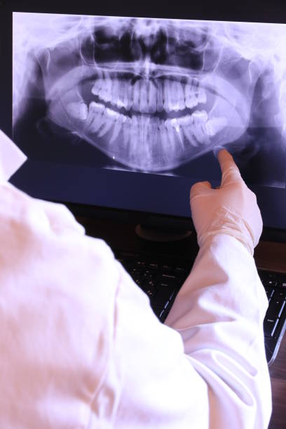 Best Emergency TMJ Treatment in Cherry Valley, CA