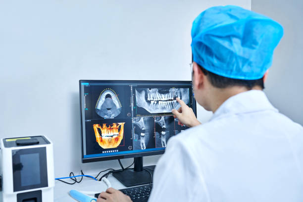 Best Emergency Root Canal Treatment in Cherry Valley, CA